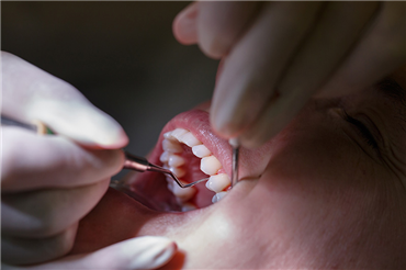 Periodontoloji